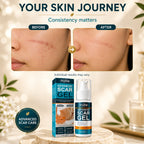 Advanced Scar Gel™ | Visible Scar & Mark Care for Smoother-Looking Skin | Pack of 2